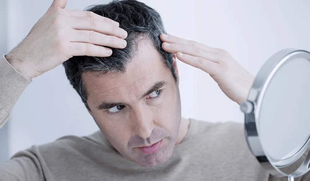 MALE PATTERN BALDNESS – Treatment in Bangkok, Causes, Symptoms of hair loss