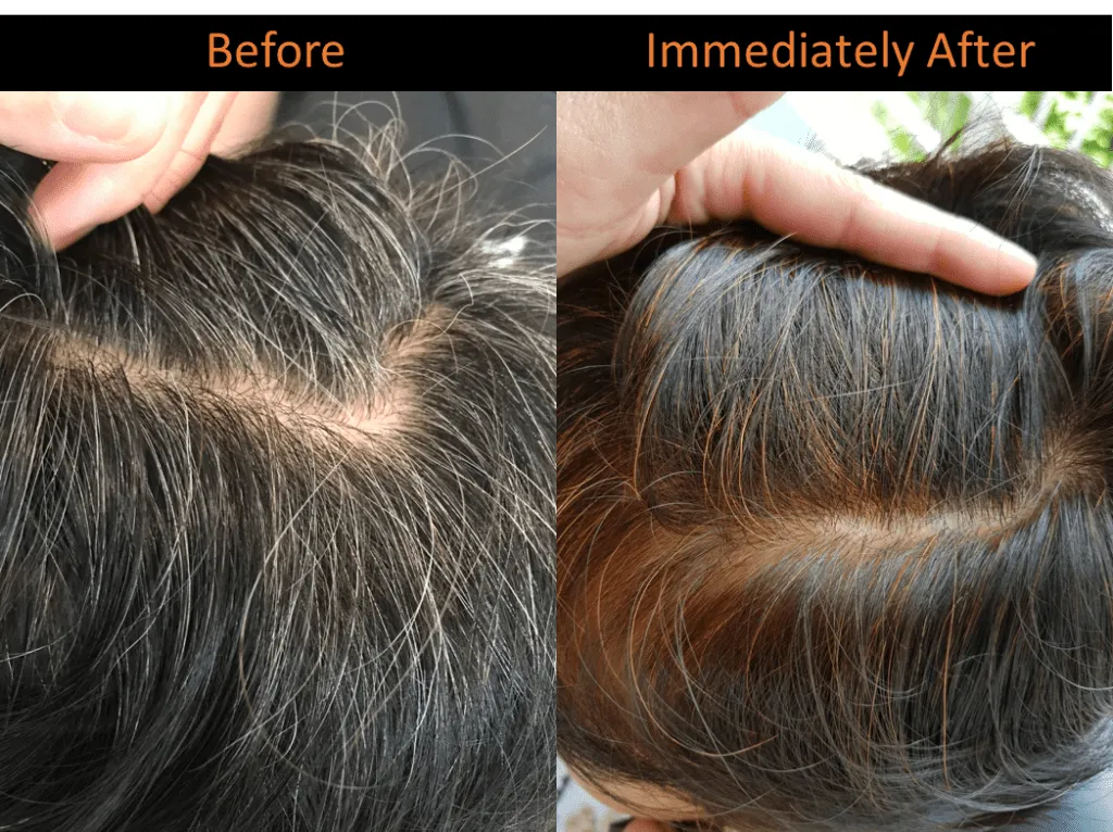 Copper dye in the herbal treatment covers white hair naturally!