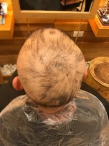 Man lose hair after chemical dye