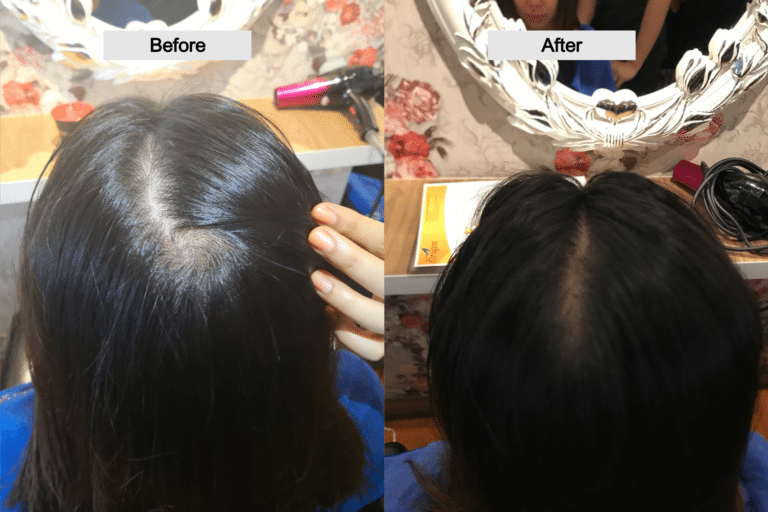 before-and-after-rachel-768x512